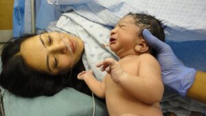 c-section birth of baby