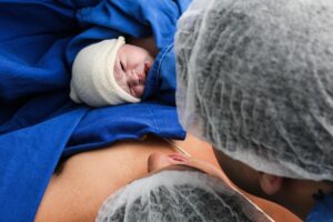 c-section birth of baby
